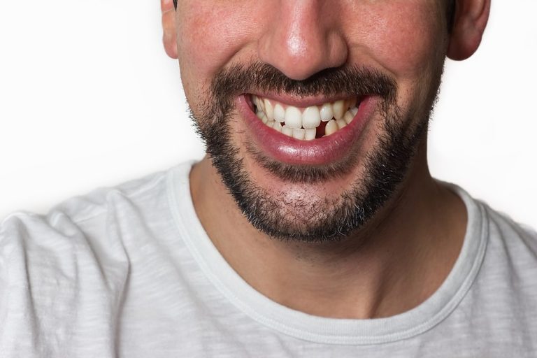 A man's smile with a missing tooth