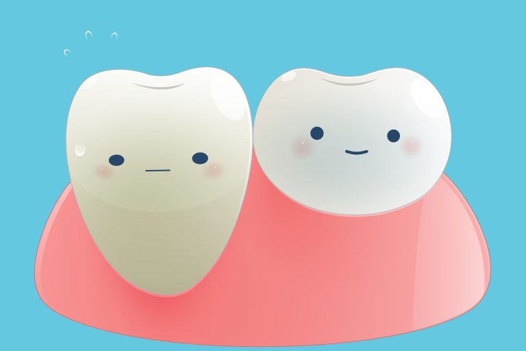 Illustration d'une dent déchaussée et d'une dent correctement protégée par la gencive