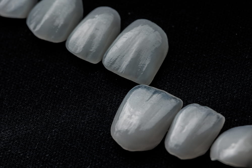 Dental veneers made from porcelain on a black background